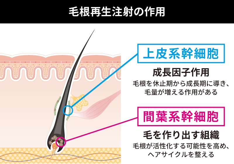 発毛注射