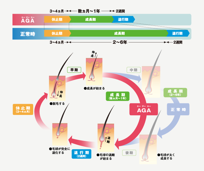 AGA進行段階
